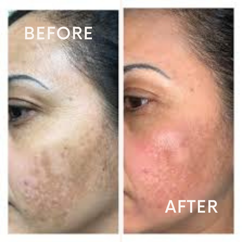 Kojic Acid  & Turmeric Brightening Soap